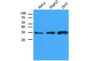 Western Blotting (WB) image for anti-Carbonyl Reductase 1 (CBR1) antibody (ABIN614308) (CBR1 anticorps)