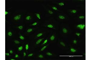 Immunofluorescence of purified MaxPab antibody to ARL6IP4 on HeLa cell.