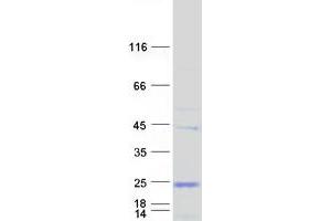 Validation with Western Blot