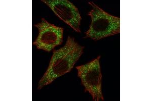Immunofluorescence (IF) image for anti-Small Nuclear Ribonucleoprotein Polypeptide E (SNRPE) antibody (ABIN3003507)