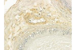 ABIN6260013 and ABIN6279138 at 1/100 staining human testicular cancer by IHC-P. (Aquaporin 8 anticorps  (N-Term))