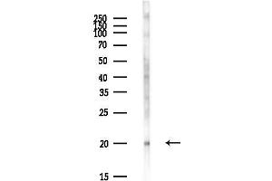 Western blot analysis of lysates from EC304 cells(LPS,4h treatment), using UBE2E1 Antibody at 1/1000 dilution.