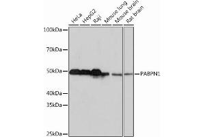 Western blot analysis of extracts of various cell lines, using P Rabbit mAb (ABIN7269445) at 1:1000 dilution. (PABPN1 anticorps)