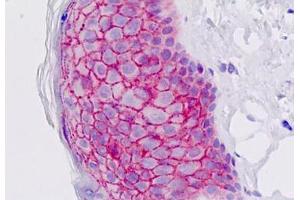 Human Skin, Epidermis: Formalin-Fixed, Paraffin-Embedded (FFPE) (EMP2 anticorps  (AA 100-129))