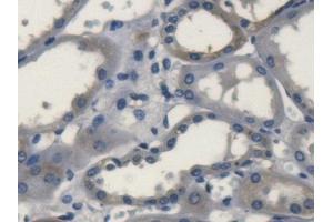 Detection of SOD3 in Human Kidney Tissue using Polyclonal Antibody to Superoxide Dismutase 3, Extracellular (SOD3)