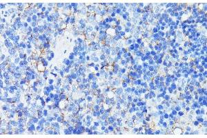 Immunohistochemistry of paraffin-embedded Rat spleen using MADCAM1 Polyclonal Antibody at dilution of 1:100 (40x lens). (MADCAM1 anticorps)