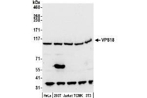 Western Blotting (WB) image for anti-Vacuolar Protein Sorting 18 Homolog (VPS18) (AA 1-50) antibody (ABIN7450897)