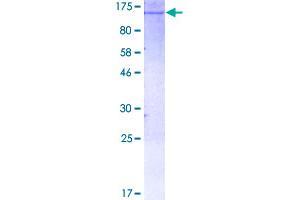 Hexokinase 1 (HK1) (AA 1-917) protein (GST tag)