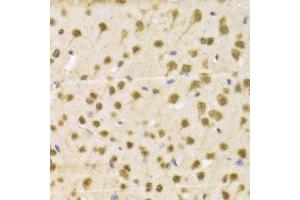 Immunohistochemistry of paraffin-embedded Mouse brain using NeuN antibody at dilution of 1:100 (x400 lens). (NeuN anticorps  (AA 1-220))
