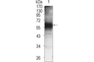 Western blot analysis using TEC mouse mAb against TEC (aa90-240)-hIgGFc transfected HEK293 cell lysate (1).