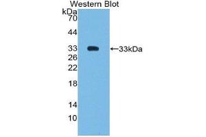 Western Blotting (WB) image for anti-SMAD, Mothers Against DPP Homolog 6 (SMAD6) (AA 171-441) antibody (ABIN1980463) (SMAD6 anticorps  (AA 171-441))