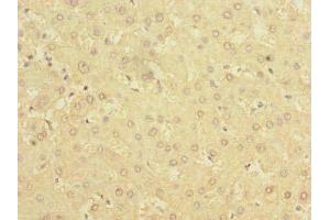 Immunohistochemistry of paraffin-embedded human liver tissue using ABIN7142304 at dilution of 1:100