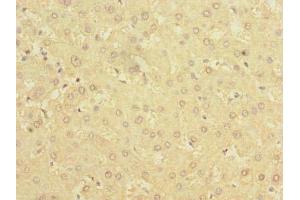 Immunohistochemistry of paraffin-embedded human liver tissue using ABIN7142304 at dilution of 1:100 (BDH2 anticorps  (AA 1-245))