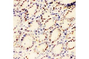 IHC analysis of EWSR1 using anti-EWSR1 antibody (ABIN3043825). (EWSR1 anticorps  (Middle Region))