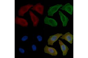 ABIN6264150 and ABIN6277603 staining Hela cells(45 min of heat-shock) by IF/ICC.