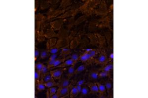 Immunofluorescence analysis of C6 cells using MMP3 Polyclonal Antibody (ABIN3021708, ABIN3021709, ABIN3021710 and ABIN6215578) at dilution of 1:100 (40x lens). (MMP3 anticorps  (AA 248-477))