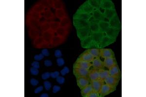 ABIN6264828 and ABIN6278632 staining Hela cells(30 min of UV treatment) by IF/ICC. (RPL14 anticorps  (Internal Region))