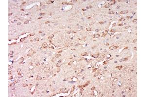 Paraformaldehyde-fixed, paraffin embedded rat brain, Antigen retrieval by boiling in sodium citrate buffer (pH6) for 15min, Block endogenous peroxidase by 3% hydrogen peroxide for 30 minutes, Blocking buffer (normal goat serum) at 37°C for 20min, Antibody incubation with Rabbit Anti-CCDC82 Polyclonal Antibody, Unconjugated  at 1:500 overnight at 4°C, followed by a conjugated secondary for 90 minutes and DAB staining.