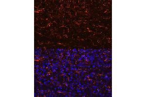 Immunofluorescence analysis of human spleen using CCR7 Rabbit mAb (ABIN7266309) at dilution of 1:100 (40x lens).