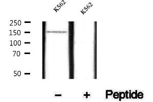 Western blot analysis of extracts of K562 cells, using Phospho-SHIP2 (Tyr986/987) Antibody. (INPPL1 anticorps  (pTyr986, pTyr987))