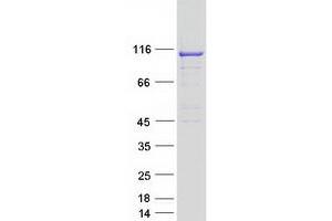 Validation with Western Blot