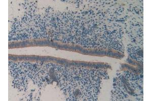 DAB staining on IHC-P; Samples: Mouse Uterus Tissue
