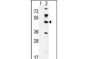 Western blot analysis of GK (arrow) using rabbit polyclonal GK Antibody (C-term) (ABIN651665 and ABIN2840349). (GKAP1 anticorps  (C-Term))