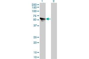 Western Blot analysis of CCT7 expression in transfected 293T cell line by CCT7 monoclonal antibody (M01), clone 1D6.