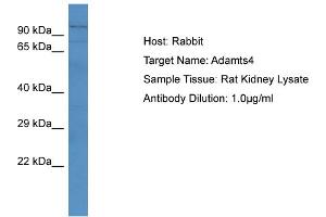 Host: RabbitTarget Name: Adamts4Antibody Dilution: 1.