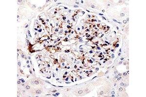 Immunohistochemical analysis of paraffin-embedded human kidney using FABP4 antibody at 1:25 dilution. (FABP4 anticorps)