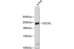 Western blot analysis of extracts of Jurkat cells, using DOCK2 antibody (ABIN1679578, ABIN5664348 and ABIN5664349). (DOCK2 anticorps  (AA 1551-1830))