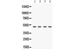 Western blot analysis of RNH1 expression in rat testis extract (lane 1), mouse brain extract (lane 2), human placenta extract (lane 2) and K562 whole cell lysates (lane 4). (RNH1 anticorps  (N-Term))