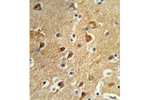 Formalin-fixed and paraffin-embedded human brain tissue reacted with PPM1H Antibody , which was peroxidase-conjugated to the secondary antibody, followed by DAB staining. (PPM1H anticorps  (Middle Region))