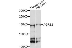 Western blot analysis of extracts of various cell lines, using AGRB2 antibody (ABIN6290298) at 1:3000 dilution. (BAI2 anticorps)