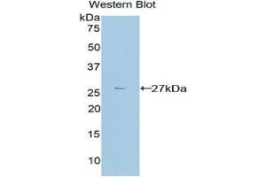 Western blot analysis of recombinant Mouse TGFbI. (TGFBI anticorps  (AA 423-632))