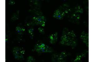 Image no. 6 for anti-Proteasome (Prosome, Macropain) 26S Subunit, ATPase, 3 (PSMC3) antibody (ABIN1501331) (PSMC3 anticorps)