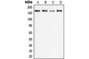 Western blot analysis of PLC gamma 1 expression in HEK293T (A), HeLa (B), SP2/0 (C), PC12 (D) whole cell lysates. (Phospholipase C gamma 1 anticorps  (Center))
