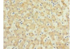 Immunohistochemistry of paraffin-embedded human liver tissue using ABIN7156807 at dilution of 1:100 (IL17 Receptor B anticorps  (AA 18-292))