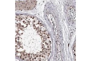 Immunohistochemical staining of human testis with RNF44 polyclonal antibody  shows moderate nuclear positivity in cells in seminiferus ducts at 1:20-1:50 dilution. (RNF44 anticorps)