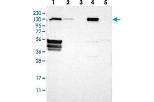 Western blot analysis of Lane 1: RT-4, Lane 2: U-251 MG, Lane 3: Human Plasma, Lane 4: Liver, Lane 5: Tonsil with FLII polyclonal antibody  at 1:250-1:500 dilution.