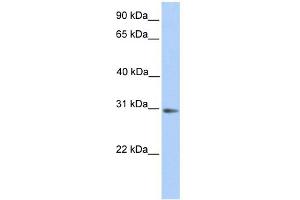WB Suggested Anti-ABHD13 Antibody Titration:  0. (ABHD13 anticorps  (N-Term))