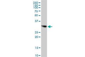 CBR1 MaxPab polyclonal antibody.