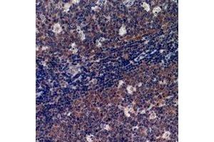 Immunohistochemical analysis of p47 phox staining in human tonsil formalin fixed paraffin embedded tissue section. (NCF1 anticorps  (C-Term))