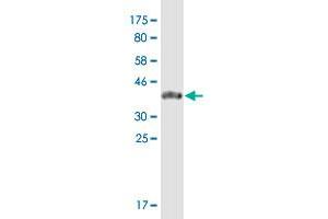 Western Blot detection against Immunogen (39. (ZNF585A anticorps  (AA 1-113))