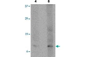 Western blot analysis of P53AIP1 in HL-60 cell lysate with P53AIP1 polyclonal antibody  at 4 and 8 ug/mL . (TP53AIP1 anticorps  (N-Term))