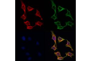 ABIN6259690 and ABIN6266757 staining Hela by IF/ICC.