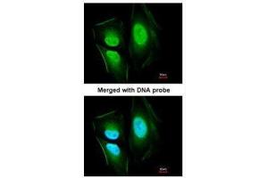 ICC/IF Image Immunofluorescence analysis of paraformaldehyde-fixed HeLa, using KIAA0494, antibody at 1:200 dilution. (KIAA0494 anticorps  (Center))