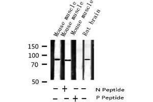 Western blot analysis of Phospho-SP1 (Thr453) expression in various lysates