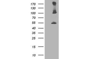 Western Blotting (WB) image for anti-Proteasome (Prosome, Macropain) 26S Subunit, Non-ATPase, 2 (PSMD2) antibody (ABIN1500481) (PSMD2 anticorps)