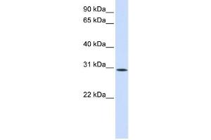 Western Blotting (WB) image for anti-Sushi Domain Containing 6 (SUSD6) antibody (ABIN2459068) (SUSD6/KIAA0247 anticorps)